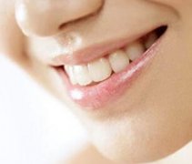 牙齿敏感的人能做牙齿美白吗